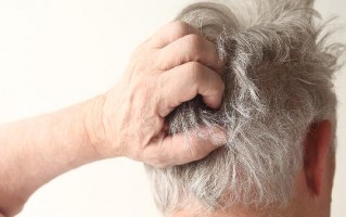 脱发是什么原因？，脱发是什么原因引起的女性